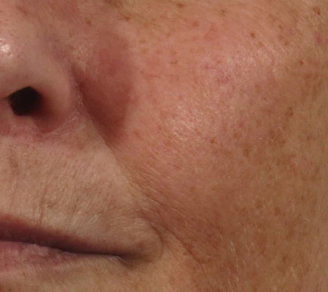 Before image