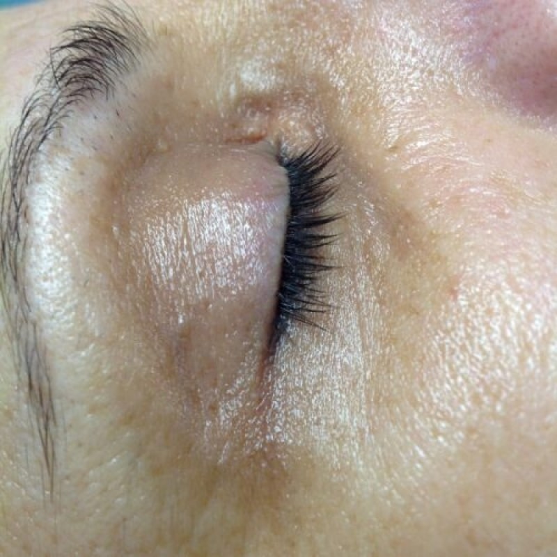 After image