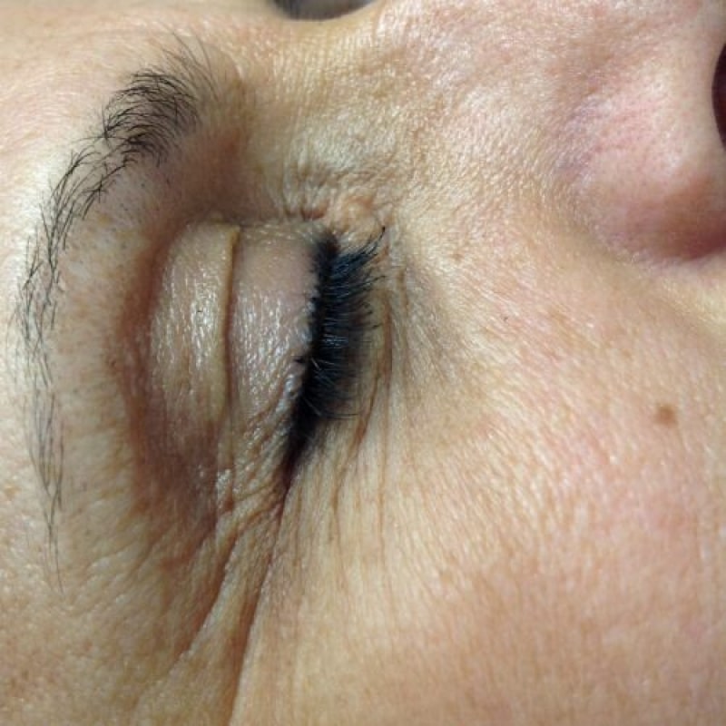 Before image