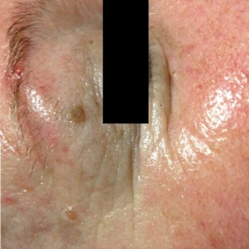 After image