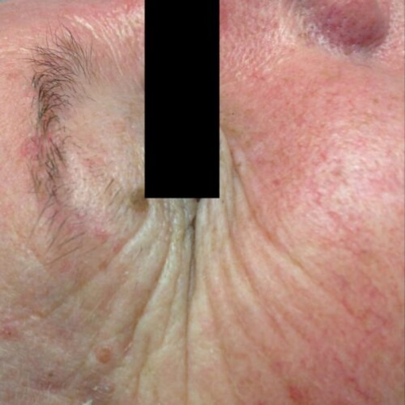 Before image